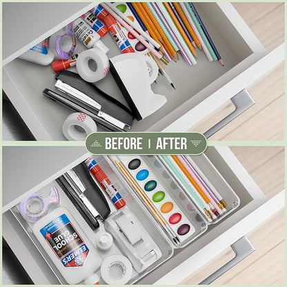 Sorbus Clear Plastic Storage Bins for Organizing, 15 Pack Clear Organizer Bins with Handles, Plastic Storage Bins for Closet,